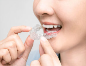 下赤塚（練馬区田柄）の歯医者、藤山歯科クリニックで歯科矯正中の食事のポイントと治療をスムーズに進めるためのコツを解説