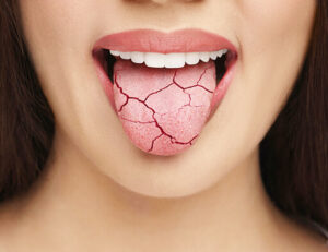 下赤塚（練馬区田柄）の歯医者、藤山歯科クリニックで、コーヒーと歯周病の関係性を解説